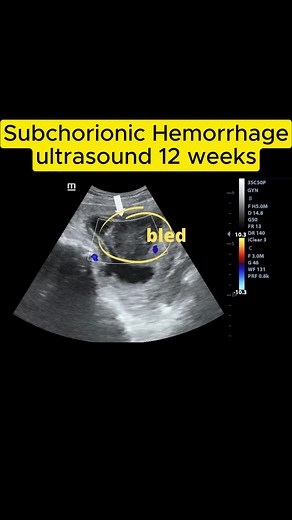 Baby Ultra Sound on TikTok