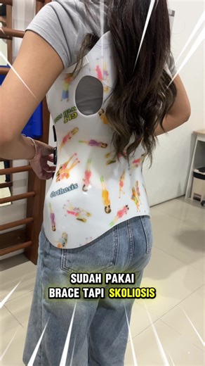 Brace Skoliosis: Tips dan Konsultasi Pemakaian yang Efektif