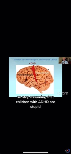 Comment “full lecture” if you want the full lecture! Discover how to overcome ADHD and manage your daily challenges more effectively. https://shapeupplans.com/collections/adhd #adhd #adhdawareness #adhdproblems #adhdmom #adhdlife #adhdparenting #adhdkids #adhdsupport #adhdbrain #adhdisreal #adhdwomen #adhdprobs #adhdmemes #adhdtips #ADHDAwarenessMonth | Shape Up Plans