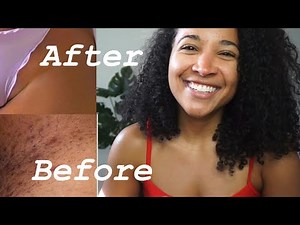 How To Lighten Dark Bikini Line For GOOD! No more dark spots.100% works!
