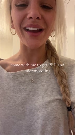 session 1/3 done!!! | micro needling