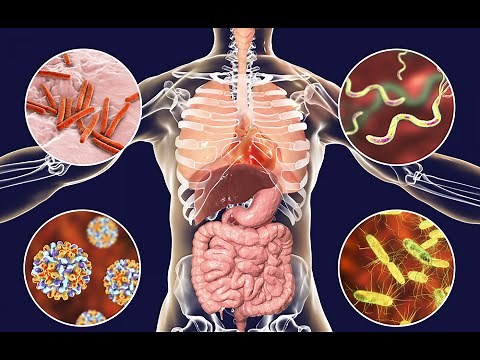 Bacterial Infections: Causes, Symptoms, and Treatments (3 Minutes)