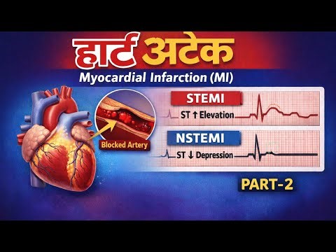 हार्ट अटैक (MI) Part-2 | STEMI vs NSTEMI | ECG Changes