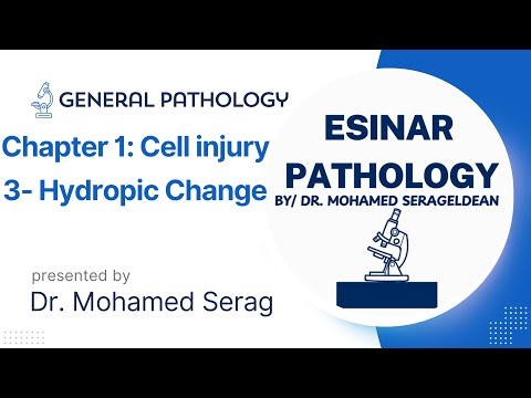 Lecture 3: Reversible Cell Injury (Hydropic Change)