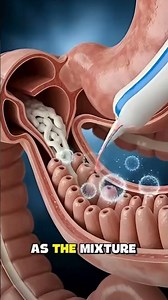 Swallowed Toothpaste by Accident? Here’s What You