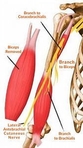 Could ONE nerve be the key to full arm mobility? The...