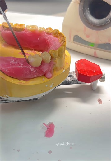 Teeth arrangement for RPD! #dentalstudent #removablepartialdenture