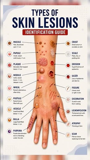Skin Lesions Types Explained | Important Dermatology Terms | #shorts
