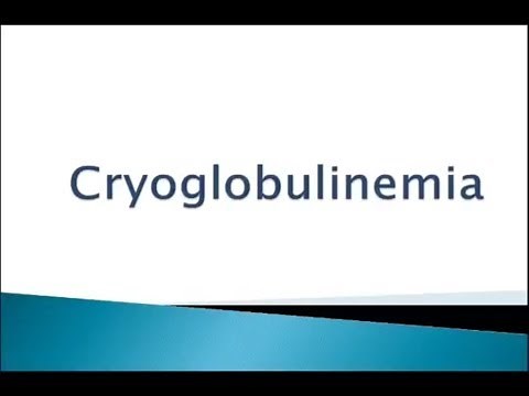 USMLE: What you need to know about Cryoglobulinemia by usmleTeam