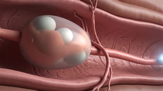 Inside View of Baby Twins in the Womb