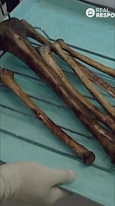 Discover the intricate process of cleaning and identifying skeletal remains. Burned and fragmented bones present unique challenges, requiring specialized techniques. Learn how experts piece together the past. #SkeletalRemains #ForensicScience #Archaeology #BoneIdentification #Anthropology From: The New Detectives Series 06 Episode 04 | Real Responders