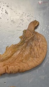 Institute of Human Anatomy | In this live session we use the cadaver dissections to discuss esophageal and stomach conditions such as GERD, gastritis, ulcers, etc. . .... | Instagram