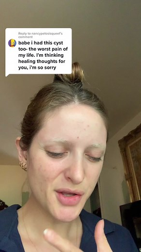 Understanding Tonsil Cysts: Symptoms, Causes & Treatment Options