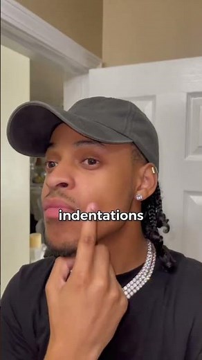 #shorts i learned how to get dimples naturally