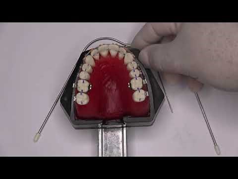 ARCO EXTRAORAL Y MÁSCARA FACIAL. #ORTODONCIA, #ORTOPEDIA