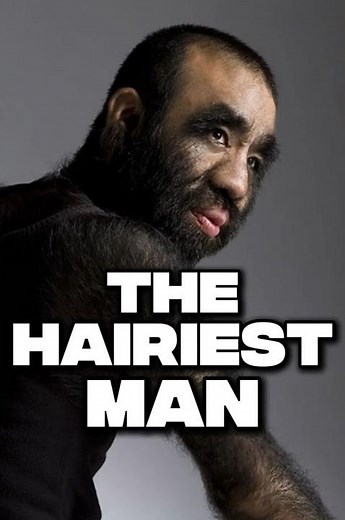 The Hairiest Man Alive… and How He Owned It