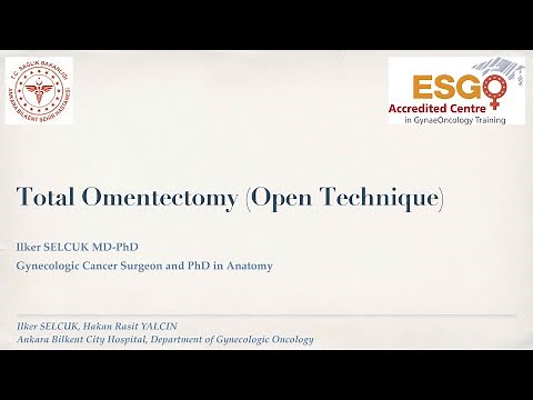 Total (infragastric) Omentectomy (open technique), 2020, Ilker SELCUK