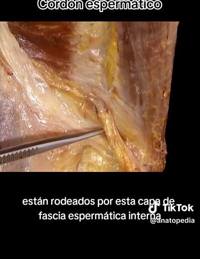 El cordón espermático y su función en la anatomía masculina