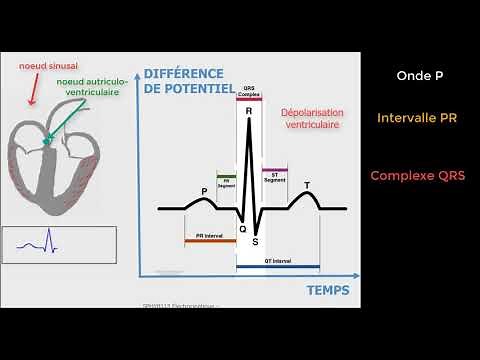 Cardiologie - Décryptage de l'ECG : tout sur l'onde PQRST !