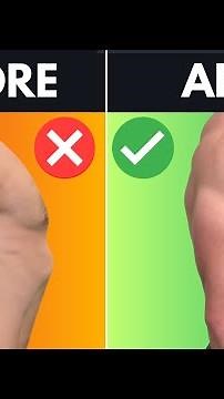 How To Fix Your Rib Flare With 1 Easy Exercise