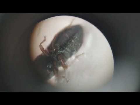 Microscopic view of an insect🪳.