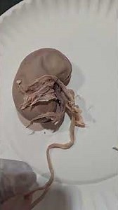 NDSCS BIOL 221LAB Kidney Dissection