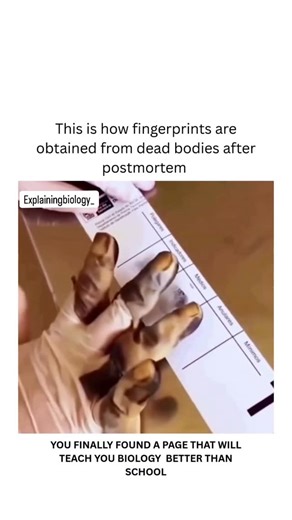 BIOLOGY | MEDICAL | HEALTH on Instagram: "Fingerprint Extraction After Postmortem In forensic science, fingerprints are one of the most reliable methods for identifying a deceased individual. Even after death, the unique ridges on the fingertips remain intact and can be recovered for investigation. When the skin is damaged or dehydrated,forensic experts use techniques such as rehydration, chemical treatment, or even removing the outer skin to access the ridge patterns. These methods help restore