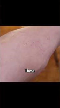 Top 7 Scary Plants You Should NEVER Touch - Part 1