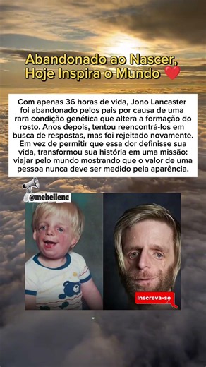 Abandonado ao Nascer, Hoje Inspira o Mundo❤️ #curiosidades
