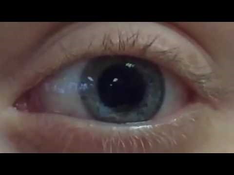 Pupil Dilation and Contraction