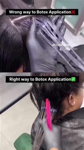 Right or wrong way to botox application #youtubeshorts #hairmaster #blessingsalon