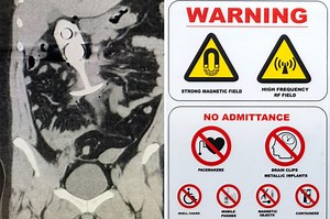 Woman left with horrific injuries after sex toy ‘dragged through body’ during nightmare MRI scan