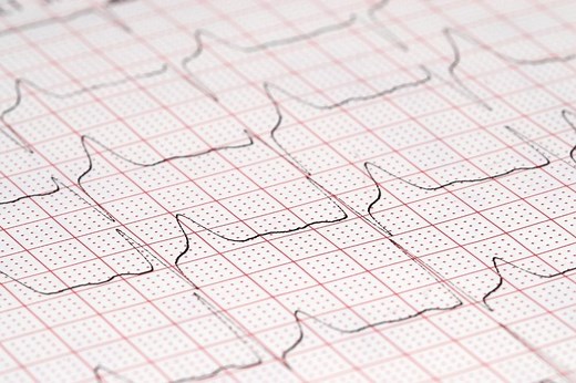 12 Kanal EKG anlegen (Anleitung   Bilder   Video)