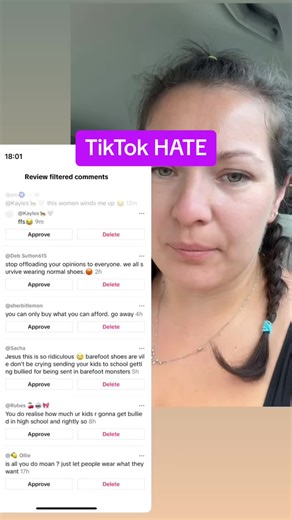 Barefoot Shoes: A Healthier Alternative to Traditional Footwear