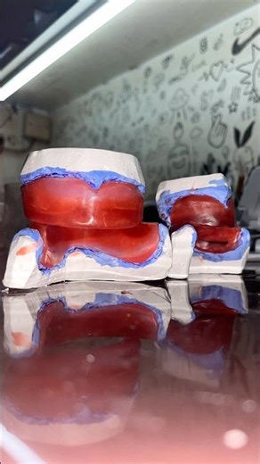 Custom Dental Tray from Wax & Light Cure Baseplate | Dental Lab Technique 🦷✨