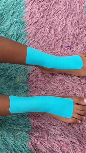 13 December2025#kinesiologytaping #footdrop #socks #lifeisbutadream #pink