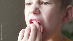 The child boy is shaking the front incisor tooth with his fingers. Loss of baby teeth