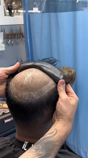 2.8K views · 19 reactions | Another amazing hair transformation #hairtransformation #... #hairsystem | Hair Systems | Facebook