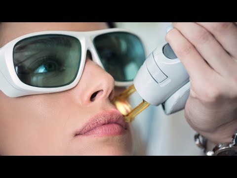 How Hair is Removed with Lasers