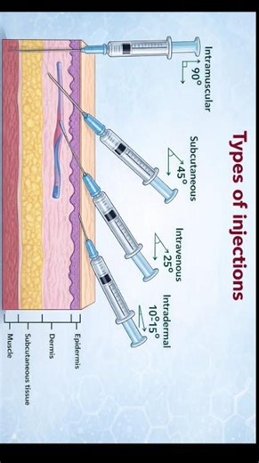 Types of Injections | IM, IV, SC, ID Injection Angles | Nursing Procedure #nursingstudents