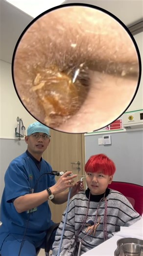 😱 कान के अंदर छुपी गंदगी कैमरे में#endoscope #earwax #shorts