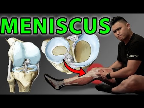 5 Best Meniscus Knee Exercises and Tests for Quick Recovery