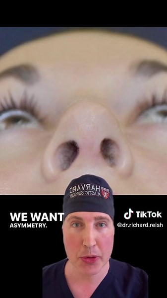 Invisible Scars: Open Rhinoplasty Scar Revision Techniques