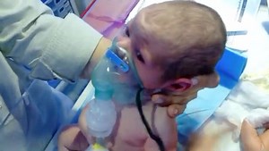 Learn how nebulizer therapy is gently given to a newborn baby to help with breathing difficulty. This video shows a calm, careful, and professional step-by-step nebulization procedure. 👶 What’s Included: How to set up the nebulizer Correct mask placement for newborns Safe positioning of the baby How to ensure smooth & comfortable breathing Important care tips for parents and caregivers ⚠️ This video is for educational purposes only. Always consult a pediatrician or neonatologist before giving a