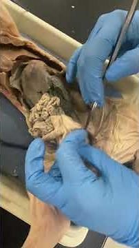 Fetal Pig: Female Reproductive and Urinary Structures