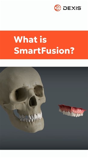 DEXIS on Instagram: "Experience the power of SmartFusion!  This DTX Studio™ Clinic feature automatically combines CBCT and intraoral scan data for 3D views of underlying anatomy so you can diagnose and treat your patients with even greater confidence. 欄 Tap the link in bio to schedule a demo today! #DEXIS #DEXIS #DigitalDentistry #DentalImaging #SmartFusion #CBCT"