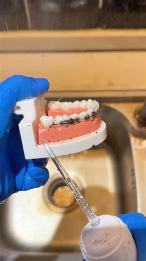 #oralhygienetips #dentalcare #glowuptips #teethcare #whiterteeth