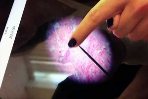 Practice Video: Epithelial Tissue