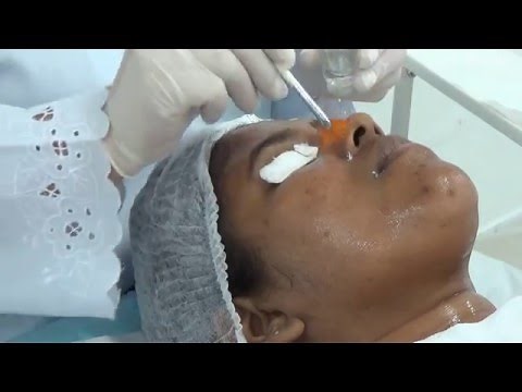 Passo-a-passo: Peeling mecânico + químico