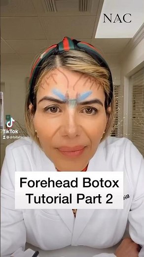 Forehead Anatomy Botox Tutorial Part 2